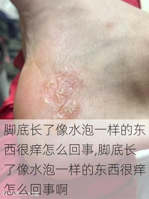 脚底长了像水泡一样的东西很痒怎么回事,脚底长了像水泡一样的东西很痒怎么回事啊