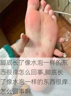 脚底长了像水泡一样的东西很痒怎么回事,脚底长了像水泡一样的东西很痒怎么回事啊